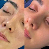 پاکسازی عمیق صورت و کمر