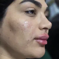 مدل ژل لب وبوتاکس فیلروغیره|خدمات آرایشگری و زیبایی|اسلام‌شهر, شهرک توحید|دیوار