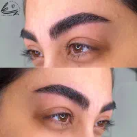 مدل میکروبلیدینگ