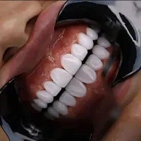 ایمپلنت از ۷۹۰۰ اقساط ۳تا۸ ماهه با گارانتی کتبی