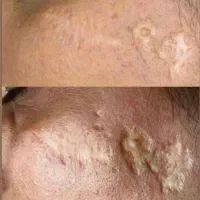 مطب پوست مو‌زارعی
