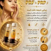 prp/prf مزوتراپی