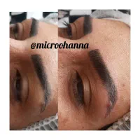 میکروبلیدینگ ابرو