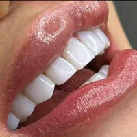 کامپوزیت ونیر فقط 3/750 تا پایان هفته|خدمات آرایشگری و زیبایی|تهران, سلسبیل جنوبی|دیوار