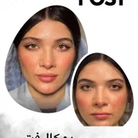 ساکشن غبغب بلفارو کاشت ابرو بوکال فت اموزش ساکشن|خدمات آرایشگری و زیبایی|تهران, میرداماد|دیوار