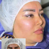 تخفیف ویژه عمل افتادگی پلک بلفاروپلاستی نقدو اقساط|خدمات آرایشگری و زیبایی|تهران, تهرانسر مرکزی|دیوار