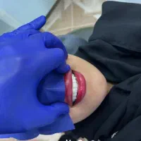 خدمات دندانپزشکی با تخقیف ویژه