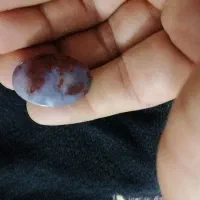 سنگ شجر