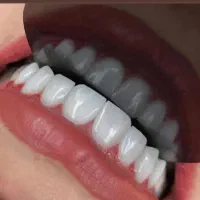 hkvign|خدمات زیبایی و سلامت|اهواز, کیانپارس |دیوار