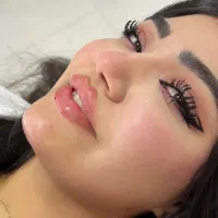 آموزش و خدمات فیلر/بوتاکس/نخ/هیپ دیپ