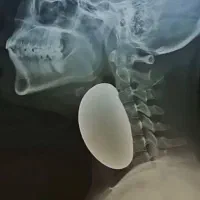 طبع سرد تو از بین ببر