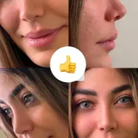 عمل جراحی بینی/ متخصص(ENT)/لیفت صورت|خدمات زیبایی و سلامت|کرج, جهانشهر|دیوار