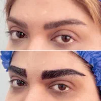 کامپوزیت لمینت ایمپلنت جراحی بینی بلفارو ساکشن|خدمات آرایشگری و زیبایی|مشهد, سجاد شهر|دیوار