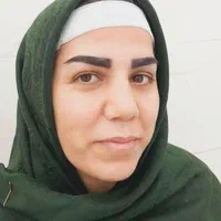 کاشت دائمی ابرو رشت|خدمات آرایشگری و زیبایی|رشت, گلسار|دیوار