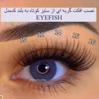 کاشت مژه هیدن ۲۰۰هزار