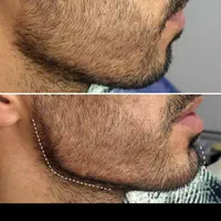 تزریق ژل و بوتاکس جوانسازی|خدمات آرایشگری و زیبایی|تهران, عبدل‌آباد|دیوار