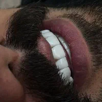 جشنواره کامپوزیت و درمانی