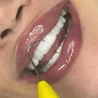 خدمات دندانپزشکی لمینت و کامپوزیت دندان|خدمات آرایشگری و زیبایی|تهران, فلسطین (میدان انقلاب)|دیوار