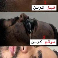 روشن کننده صورت بیکینی ،کربن تراپی تخصصی مابیوتی