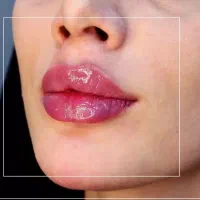 جشنواره ویژه بوتاکس و فیلر بادی و بیکینی و سینه