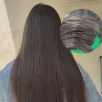 موخوره گیری/کاشت و لیفت مژه/بافت مو