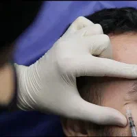 آموزش تخصصی بوتاکس ژل نخ مزو پی آرپی