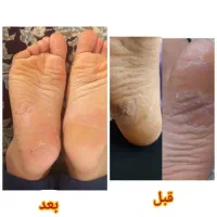 انواع روغن‌های اصل و خالص|آرایشی، بهداشتی، درمانی|تهران, بوستان چیتگر|دیوار