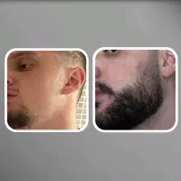 بلیت کنسرت ریشو ها