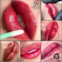 انجام خدمات شیدلب و رفع کبودی