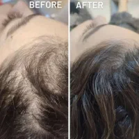 خدمات ژل و بوتاکس پلکسر و...|خدمات آرایشگری و زیبایی|کرمانشاه, |دیوار