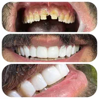 دندانپزشکی حتی در روزهای تعطیل|خدمات آرایشگری و زیبایی|مشهد, کوی ولیعصر|دیوار