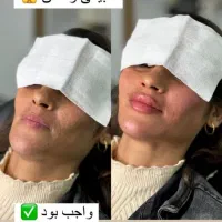 فیلر ژل بوتاکس مزو لیزر هایفو فول فیس ۵۰٪ آف|خدمات آرایشگری و زیبایی|مشهد, فرهنگ|دیوار