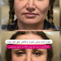 پوست،مو،زیبایی،دکتر تدین زاده|خدمات آرایشگری و زیبایی|کرج, اتحاد|دیوار