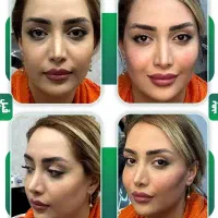 تزریق هرنوع خدمات زیبایی به صورت تضمینی