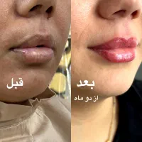 شیدینگ لب و بن مژه و خط چشم ۲ ملیون