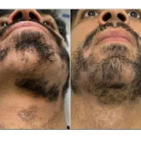 ریش وموهاتو شگفت انگیزکن
