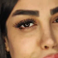 تخفیف ویژه کاشت هیدن