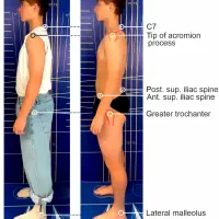 حرکت اصلاحی و آنالیز اسکلتی عضلانی