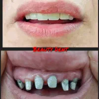 دندانسازی دندان سازی|پزشکی|مشهد, سرافرازان|دیوار