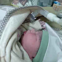 اعمال جراحی زیبایی زنان و لابیاپلاستی