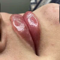 ژل و بوتاکس و پیرسینگ