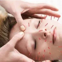 زالو درمانی حجامت و بادکش گرم طب سوزنی
