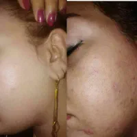 پوستت رو نجات بده با فرمول طبیعت پوست سالم