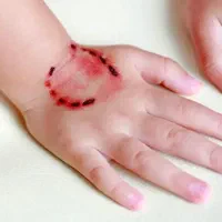 فروش تحقیق تخصصی آماده راجع به بیماری هاری
