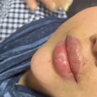 بمب تخفیف ژل و بوتاکس|خدمات آرایشگری و زیبایی|بندر امام خمینی, |دیوار