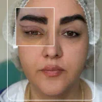 جشنواره تکرار نشدنی ساکشن غبغب و ..کلینیک پالادیوم|خدمات آرایشگری و زیبایی|شیراز, معالیآباد|دیوار