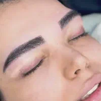 فیلر سی سی۳۳۰ بلفاروپلاستی ۶/۹۰۰ بوتاکس ۲۵۰