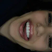 کامپوزیت زیبایی