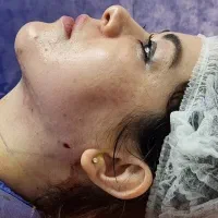 لیپوماتیک آبدو مینو پلاستی پروتز سینه شرایط اقساط|خدمات آرایشگری و زیبایی|تهران, بلوار کشاورز|دیوار