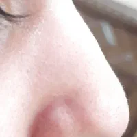 فشیال و پاکسازی